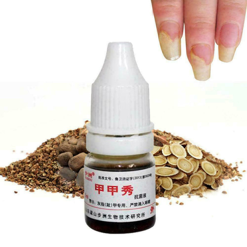 Footcare Oil 15ml Gehwol Nail Softner Fluid Ingrown Nails Callus Toe Z2L1