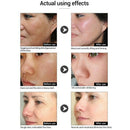 Weimei Niacinamide Stock Solution Vitamin B3 Hydrating Repair Acne Muscle F