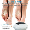 Electric Vacuum Adsorption Foot Grinder File Callus Dead Skin Remover Machine