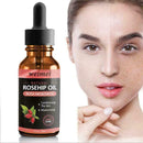 Skin Whitening Oil Brightening Dark Spot Removal 30ml Quality Essence Care V6S1