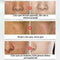 Skin Whitening Lightening Brightening Serum Acid Dark Spot Pretty Bleaching M9Y6