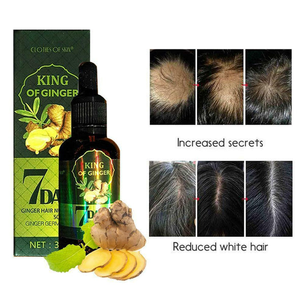 Herbal Ginger Essence for Hair Growth Hair Essential Oil Anti Hair Lose 30ml