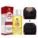 MeiYanQiong Morocco Nuts Hair Fast Powerful Growth Essence 3PCS Preventing  Q2Z9
