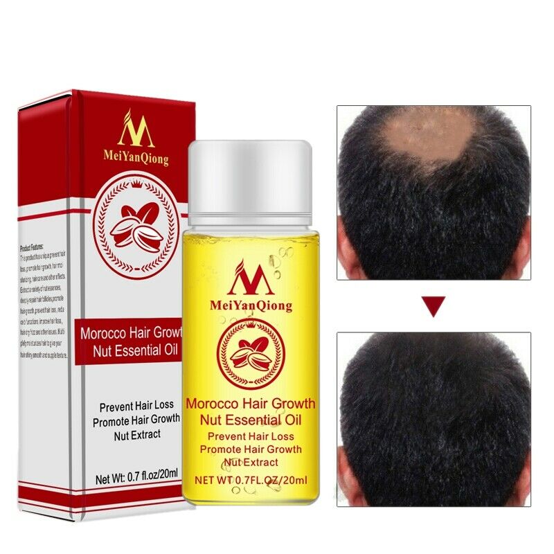 MeiYanQiong Morocco Nuts Hair Fast Powerful Growth Essence 3PCS Preventing  Q2Z9