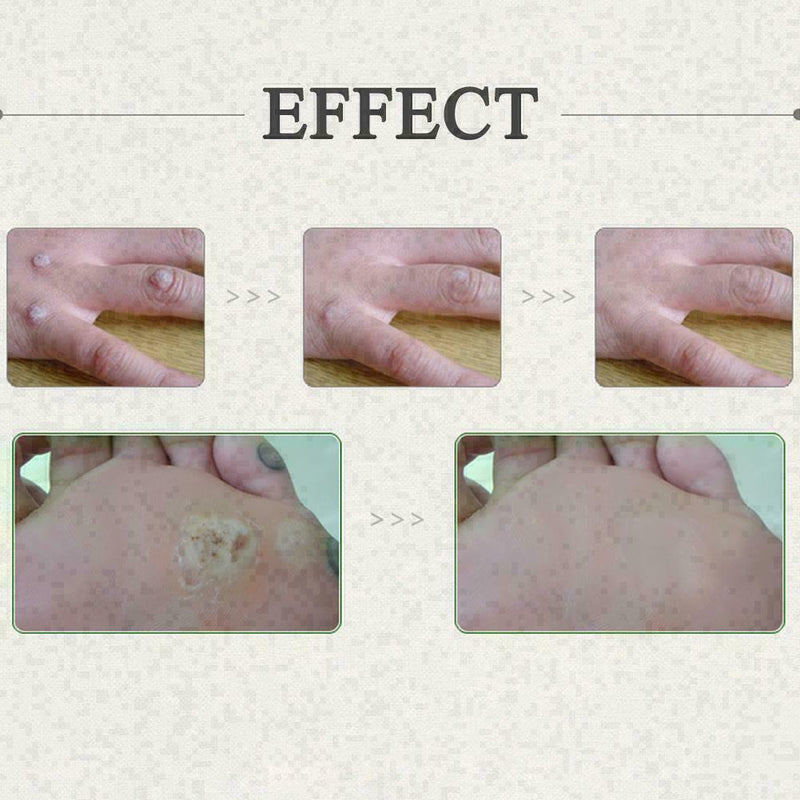 Ear Cleaner Antibacterial Solution For Pet Dog Cat Magic B6V3 100ml Z0Y6 Q4S7