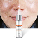 Vibrant Glamour 15ml Salicylic Acid Liquid Shrink Pore Essence Blackhead Ac U6E5