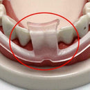 Dental Mouth Guard For Teeth Grinding, Bruxism, Dental Sleep Bite Aid Snore Z6Y2