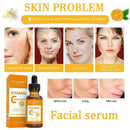 30ml Natural Vitamin C Skin, Face Serum + Anti Ageing & Retinol, Vit U6Z7