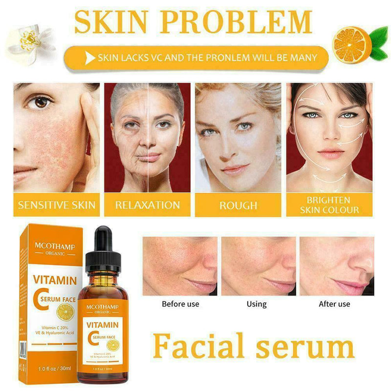 30ml Natural Vitamin C Skin, Face Serum + Anti Ageing & Retinol, Vit U6Z7