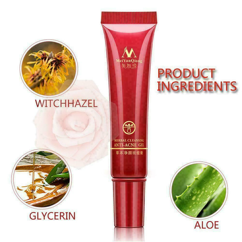15ml Crema Acne para ELIMINA Barros Manchas Espinillas I8P7 Tu RECUP Piel L U6O8