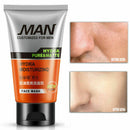 Men Fashion Face Wash Blackheads Oily Skin Foam Facial Clean Beauty Z7N3