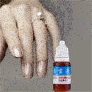 10ml Nail Repair Treatment Liquid Cleanser Onychomycosis Disinfect Water ne U6U7