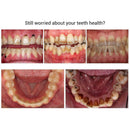 10ml Stains Oral Hygiene Cleaning Teeth Whitening Dental Effective Bleachin E3R8