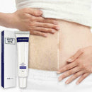 Entfernung Akne Narbe Stretch Marks Creme Fett Narbe Beha Striae Gravidarum Q2M9