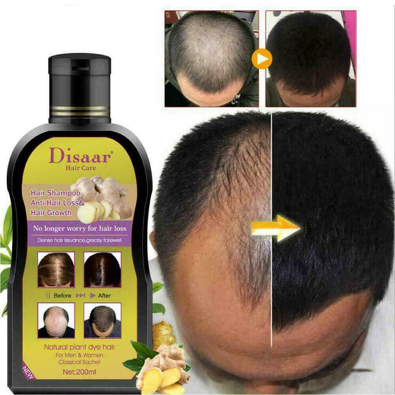 200ml Mens Womens Disaar Hair Shampoo Anti hair Loss Chinese Growth Hair N1J9