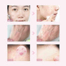 Facial Scrub Dead Skin Removal Face-Smoothing Exfoliating 160g Body Gel Cre F1F4