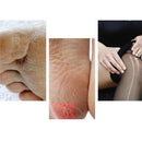 10In1 Pedicure Paddle Foot Scraper Pumice Stone Brush File For Hard Skin Remover