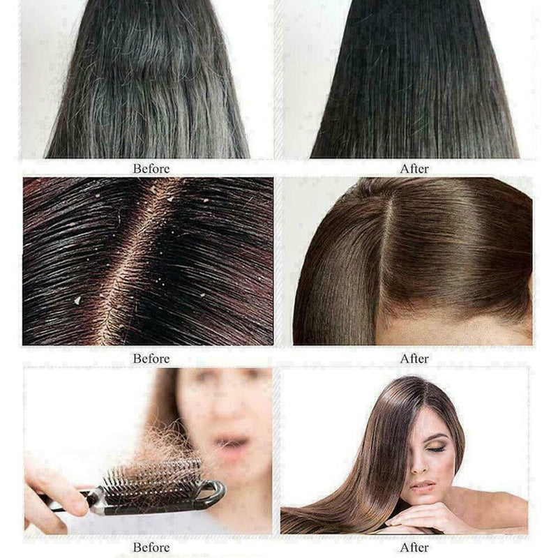 20Ml Natural Hair Growth Serum Essence Oil Hair Fiber Hair best Faster Grow W6S9