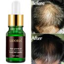 10ml 7 Day Fast Hair Growth Serum Essence Oil Hair Loss Treatment Hair Regrowth