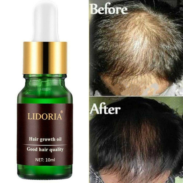 10ml 7 Day Fast Hair Growth Serum Essence Oil Hair Loss Treatment Hair Regrowth