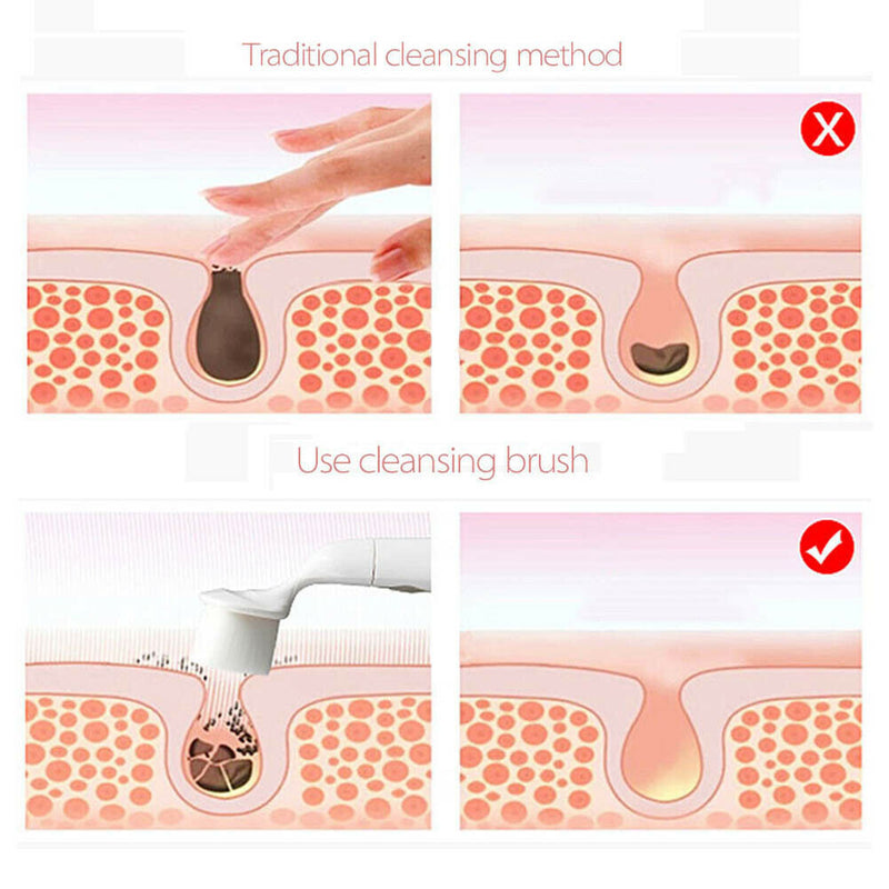 Soft Bristle Wash Pad Face Exfoliating Blackhead Facial Cleansing Brush Beauty