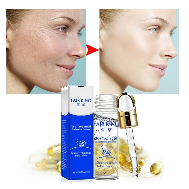 Fair King Tea Tree Hyaluronic Acid Snail Plant Extract Face Serum Whitening W5H6