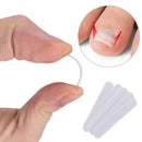 10Pcs / Lot 4Mm Embedded Toenail Correction Stickers Can Be Straightened Na L4M7