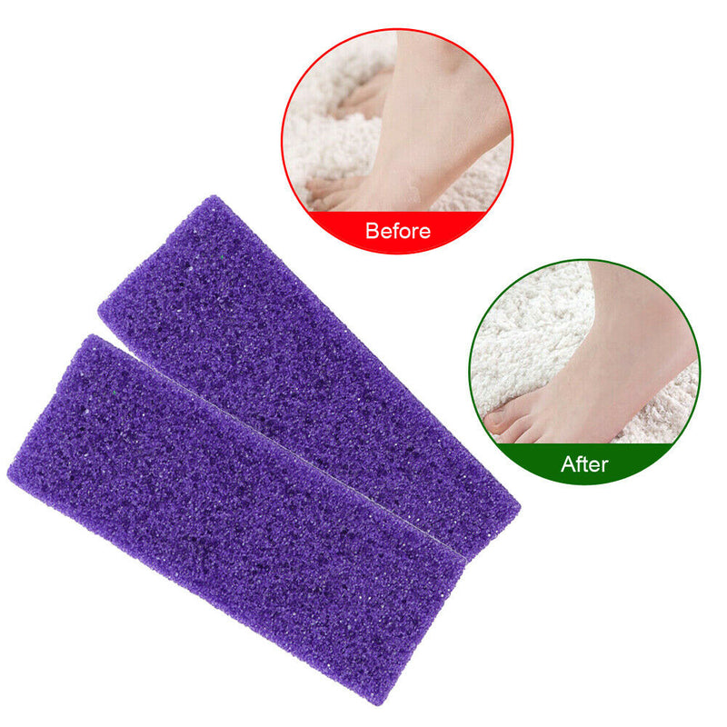 2pcs Pumice Stone Foot Care Exfoliating Scrubber Dead Hard Skin Callus Removal