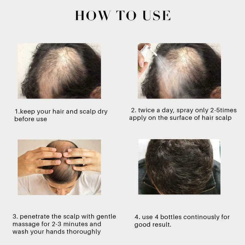 30ML Natural Hair Growth Spray Fast Thick For Men Hair Women Oil Treament Q5Y7