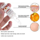 Ameizii Snail Essence Hyaluronic Acid Serum Moisturizing Whitening Lifting  I2T3