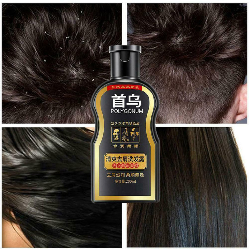 Darkening Shampoo Permanent Black Hair Shampoo Natural Ginger Coloring  Top