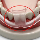 Dental Mouth Guard for Teeth Grinding, Bruxism, Dental Bite Sleep Aid Snore P5A2