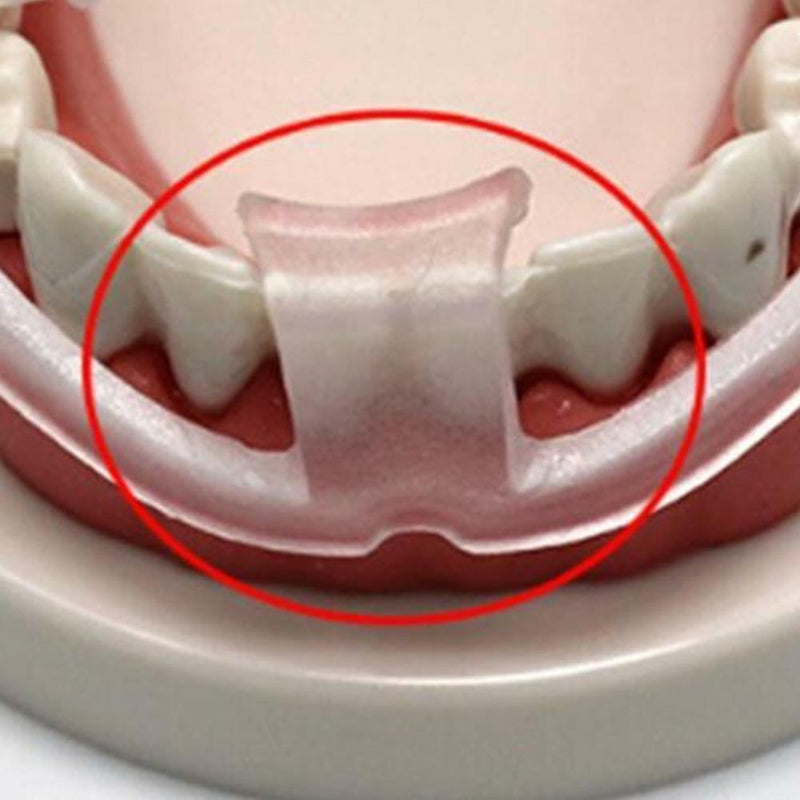 Dental Mouth Guard for Teeth Grinding, Bruxism, Dental Bite Sleep Aid Snore P5A2