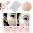 36PCS Fast Remover Pimple Patch Treatment Acne Patch Skin Tag Beauty Makeup  Nw