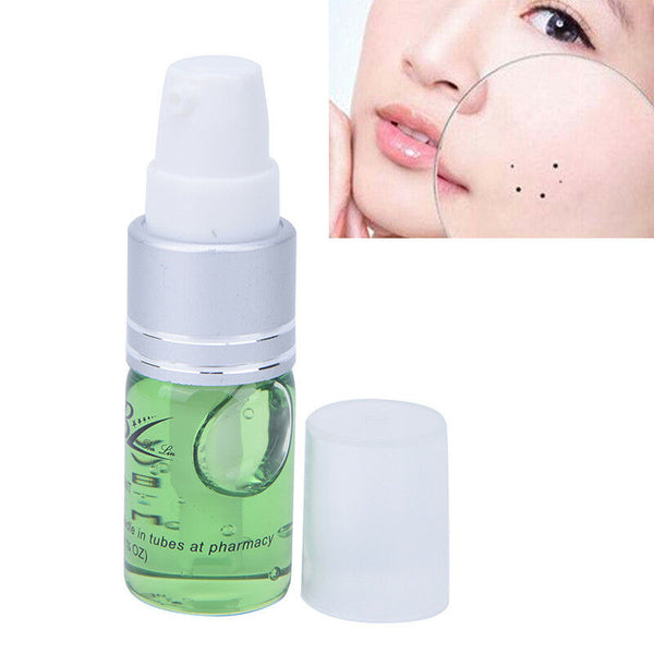 Mole#Skin Tag Repair Solution Painless Mole Skin Dark Spot Repair Face Wart B Gw