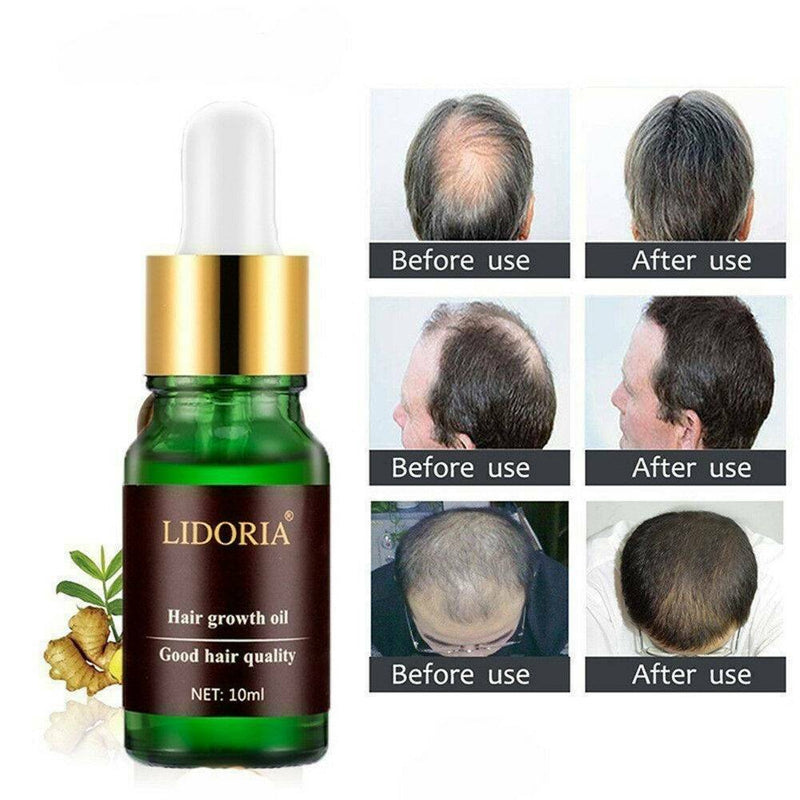10ml 7 Day Fast Hair Growth Serum Essence Oil Hair Loss Treatment Hair Regrowth
