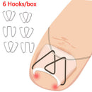 6Pcs Ingrown Toe Nail Correction Hook Fixer Pedicure Tool Toenail Care Correcto@
