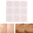 Skin Acne print Scar Away Patch Silicone Gel Sheet Wound Marks Treatment Remo 3C