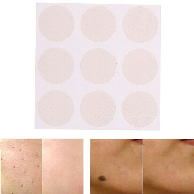 Skin Acne print Scar Away Patch Silicone Gel Sheet Wound Marks Treatment Remo 3C