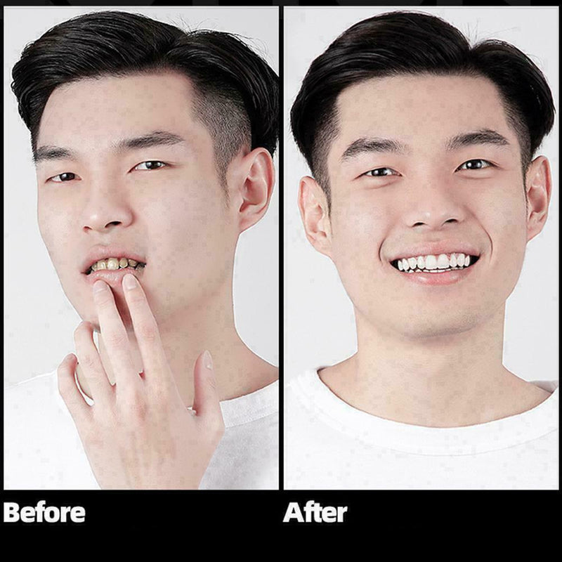 50g Teeth Whitening Powder Herbal Safe Fresh Dazzle Remove Brighten T Stain B0T9