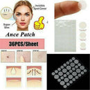 Pack of 36Pcs Invisible Acne Patch Anti Pimple Stickers Spot Scar Care Treatment