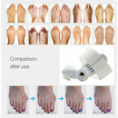 Toe Orthosis Bone Thumb Valgus Orthosis Unisex Day Night Toe Can Wear ShoesS Hn