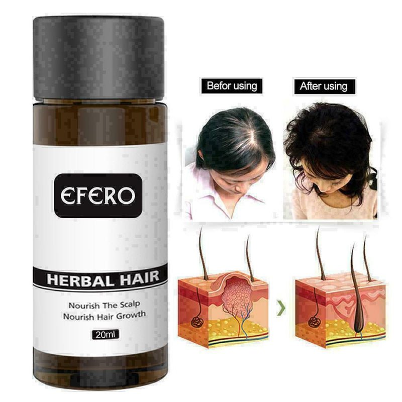 For Herbal Ginseng Raise Hair Growth Essence Hair Loss Treatment V2L8 U2E6 K6Y4