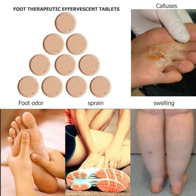 10pcs Ginger Massage Effervescent Tablets Treatment Anti-Swelling Foot SPA A