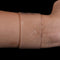Silicone Gel Sheet Scar Treatment Repair Keloid Cesarean Away Wound Removal`o Pg