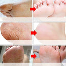 smooth and refreshing foot to improve dry, moisturizing and moisturizi P5R9