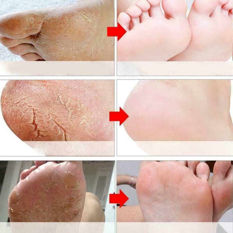 smooth and refreshing foot to improve dry, moisturizing and moisturizi P5R9