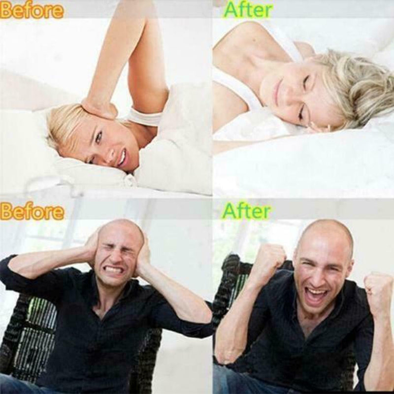 Dental Mouth Guard For Teeth Grinding, Bruxism, Dental Aid P5A2 Snore Bite U4D6