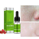 10ml Face Essence Care Hyaluronic Whitening Shrink Pores X6E5 M8E6 U6Q0