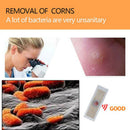 family use 42pcs foot corn remover foot callus remover medical foot corn patcJ&M